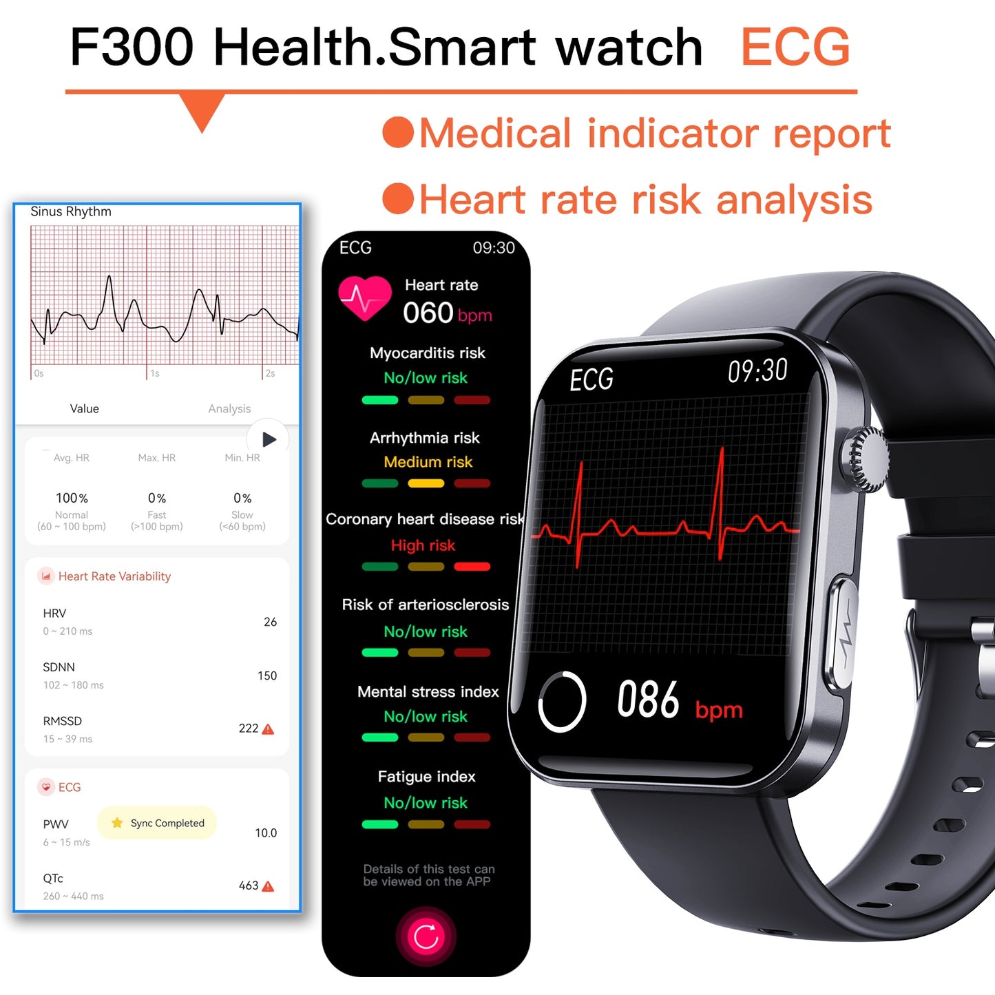 ALT: Smartwatch with ECG heart health analysis and medical report graphics.