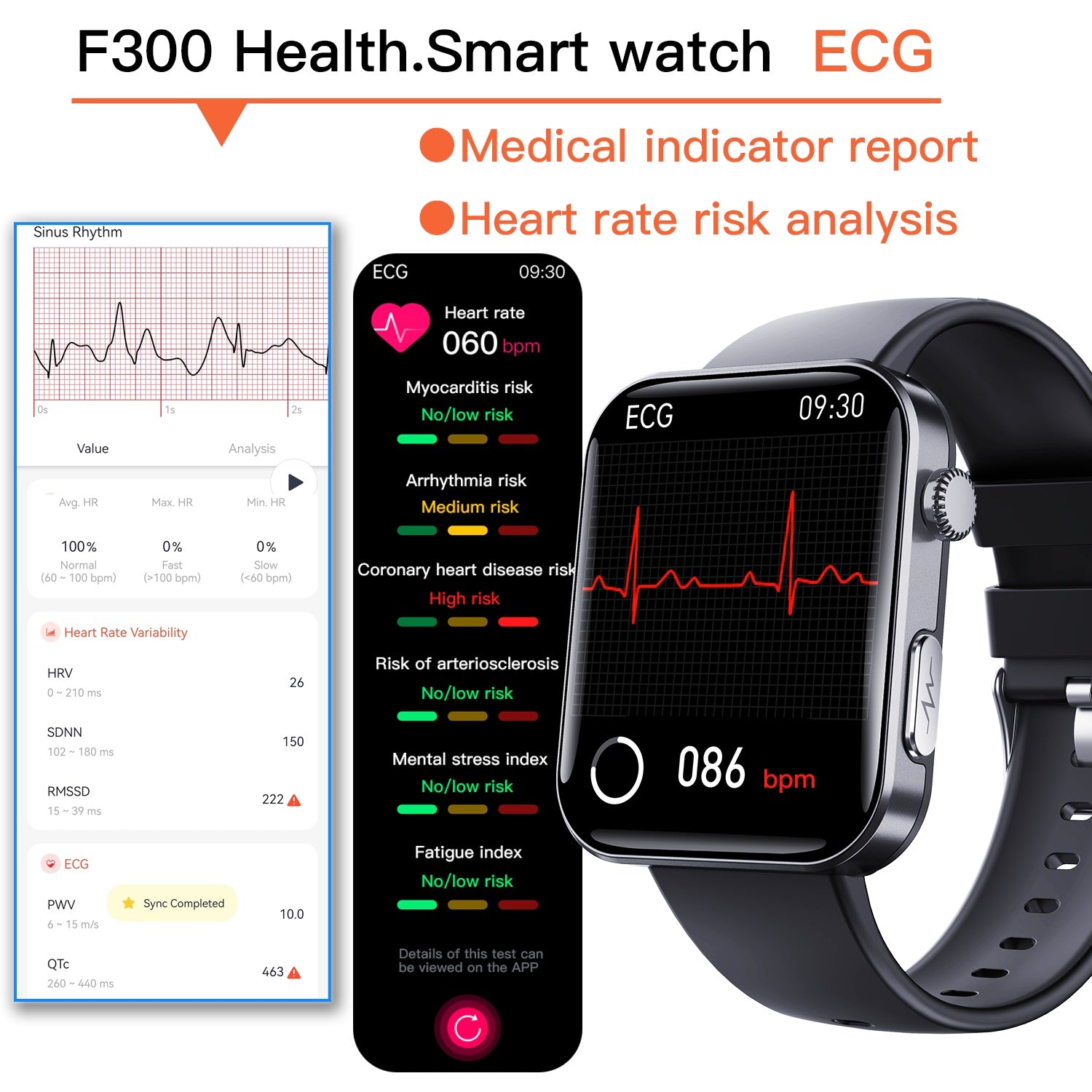 ALT: Smartwatch with ECG heart health analysis and medical report graphics.